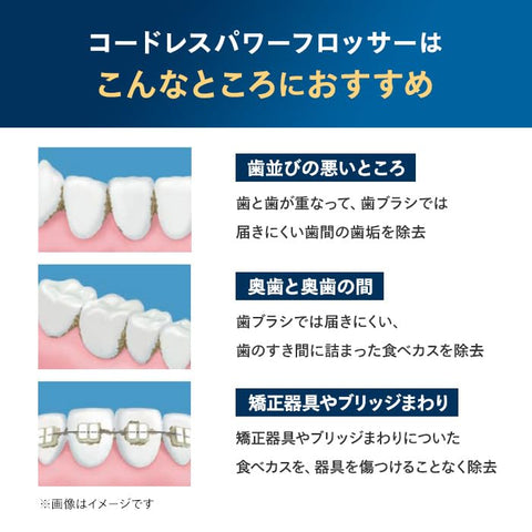 フィリップス ジェットウォッシャー ソニッケアー コードレスパワーフロッサー3000 口腔洗浄器 (X型水流ジェットウォッシャー) HX3826/23 ブラック 【Amazon.co.jp限定】