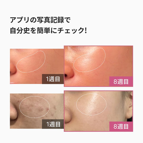 Medi Cube Booster Pro 粉色