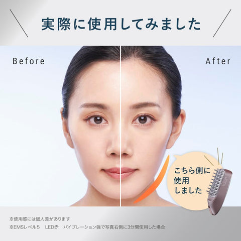 【Amazon限定おまけ付き】 スカルプD ボーテ スカルプ電気ブラシ ＋ スカルプD ボーテ 薬用 シャンプー ＆ トリートメントパック お試し用×２回分セット 医師監修 (アンファー スカルプブラシ 頭皮 ヘッドスパ 電動頭皮ブラシ 頭皮ブラシ 頭皮ケア EMS 美顔器 リフトケア 光エステ LED コードレス プレゼント 女性 ギフト)