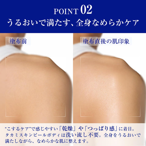 TAKAMI タカミスキンピールボディ 200g ボディゲル 乾燥 黒ずみ 角質ケア 肌見せ季節 からだ用 ボディクリーム
