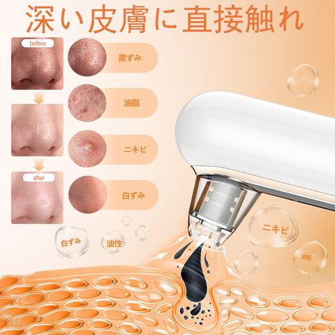Yccu 포어 아스피레이터 모공 청소 진공 흡착 페이셜 마사지 핀셋, 4가지 모드, 4개의 흡입 헤드, 모공 클렌징, 스테인 석션, 블랙헤드 리무버, 모공 관리, 코 미용 기기, 남녀공용, USB 충전식, 모공, 일본어 사용 설명서