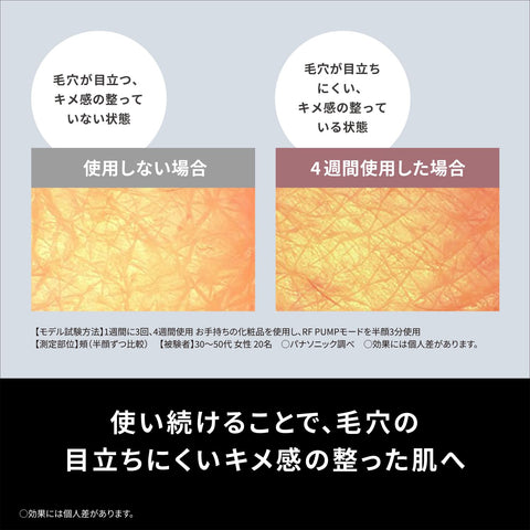 パナソニック 美顔器 バイタリフト RF 1台9役 エイジングケア 高出力RF・EMS・イオン搭載 EH-SR85-K