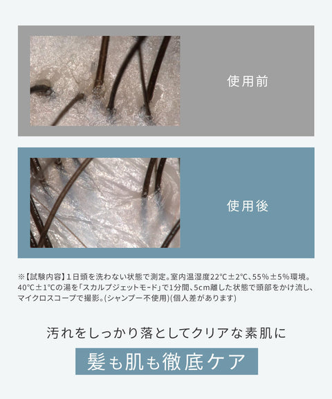 SALONIA 細氣泡透明淋浴噴頭，帶微奈米氣泡，節水，高水壓，除氯濾芯 + 碳酸氫鹽片，銀色